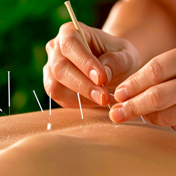 Acupuncture / Pandora Star